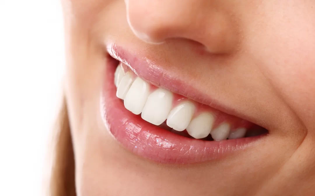 Branqueamento – fim das manchas e dentes amarelos